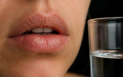 Dry Mouth: Why It Matters More Than You Think for Dental Health