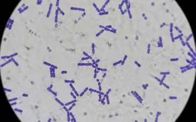 Lactobacillus Reuteri for Oral Health: The Science Behind the Strain