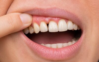 Loose Teeth in Adults: What Causes Them and What Can Be Done