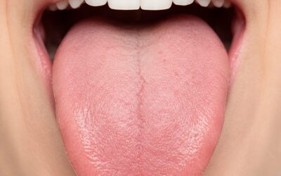 What Your Tongue Says About Your Health